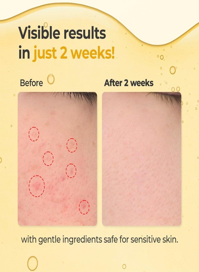 HEEDA Glutathione All-In-One Brightening Serum – Niacinamide, Kojic Acid & Turmeric Formula for Dark Spots, Radiant, Glowing, Even-Tone Skin - Image 3